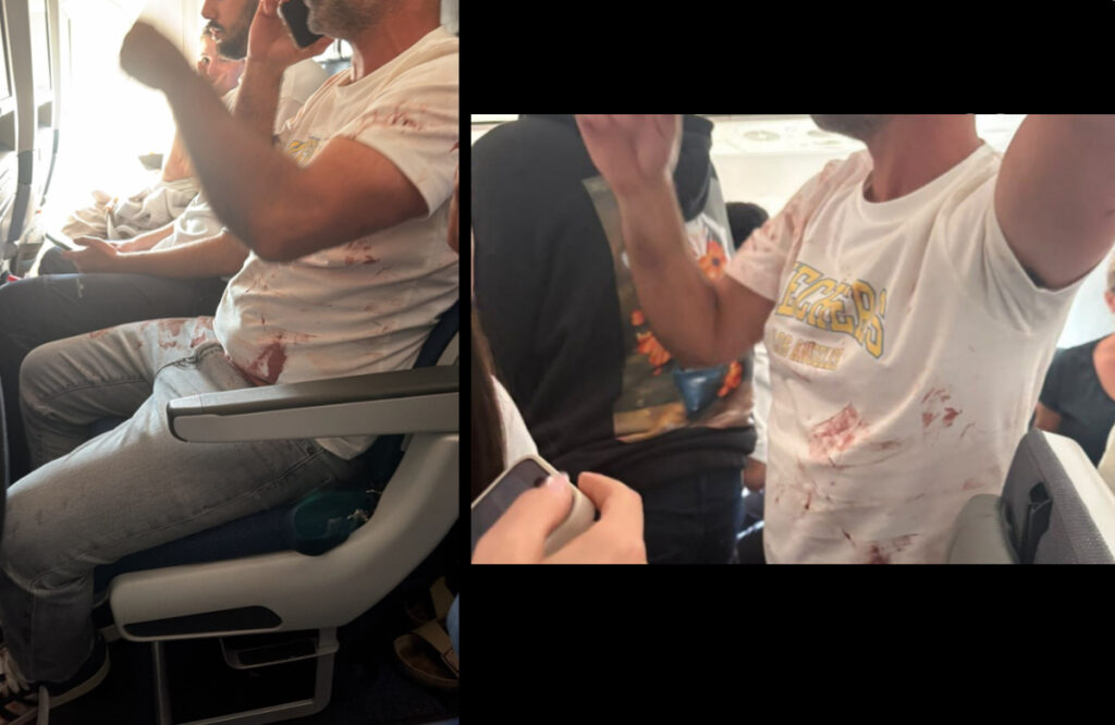 «Ακούσαμε κραυγές… Το αεροσκάφος έκανε βουτιά»: Θρίλερ στον αέρα – Τι συνέβη στην πτήση από Ντουμπάι προς Τελ Αβίβ