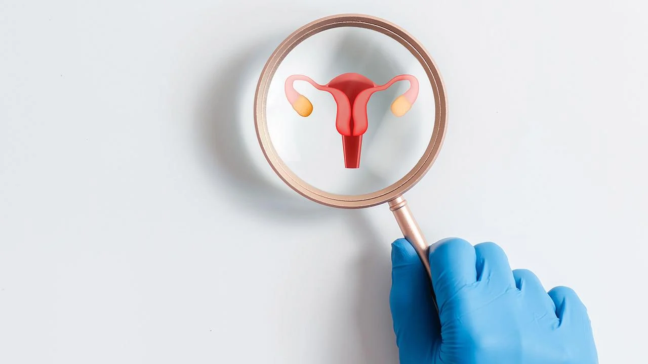 Tο σύνδρομο πολυκυστικών ωοθηκών μπορεί να συνδέεται με άνοια και Alzheimer [ανασκόπηση]